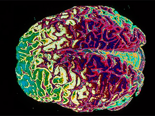 Биоинженеры вырастили копию мозга