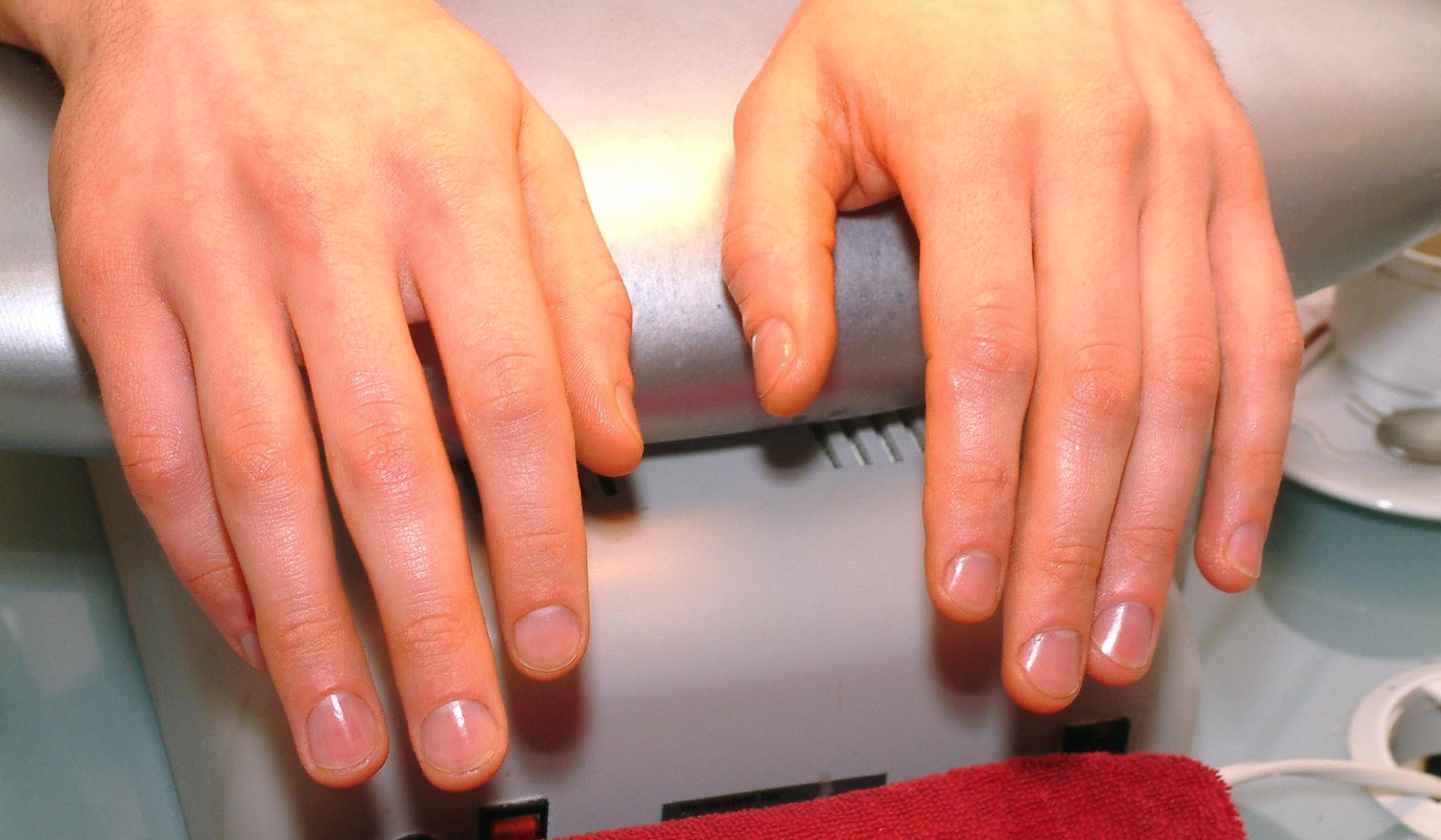 Появление белых пятнышек на ногтях