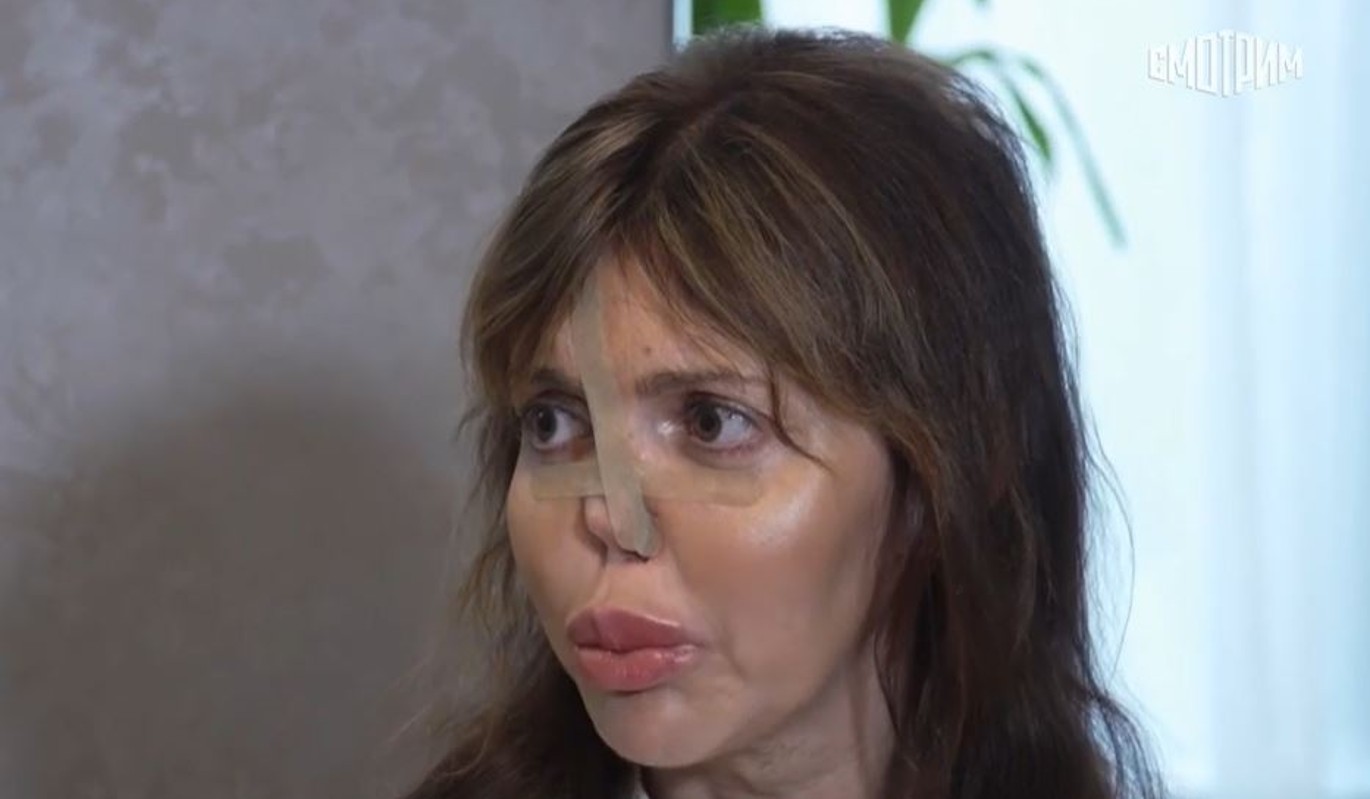 "Восставшая из пепла": смотрим на экс-жену Аршавина "до" и "после" операции