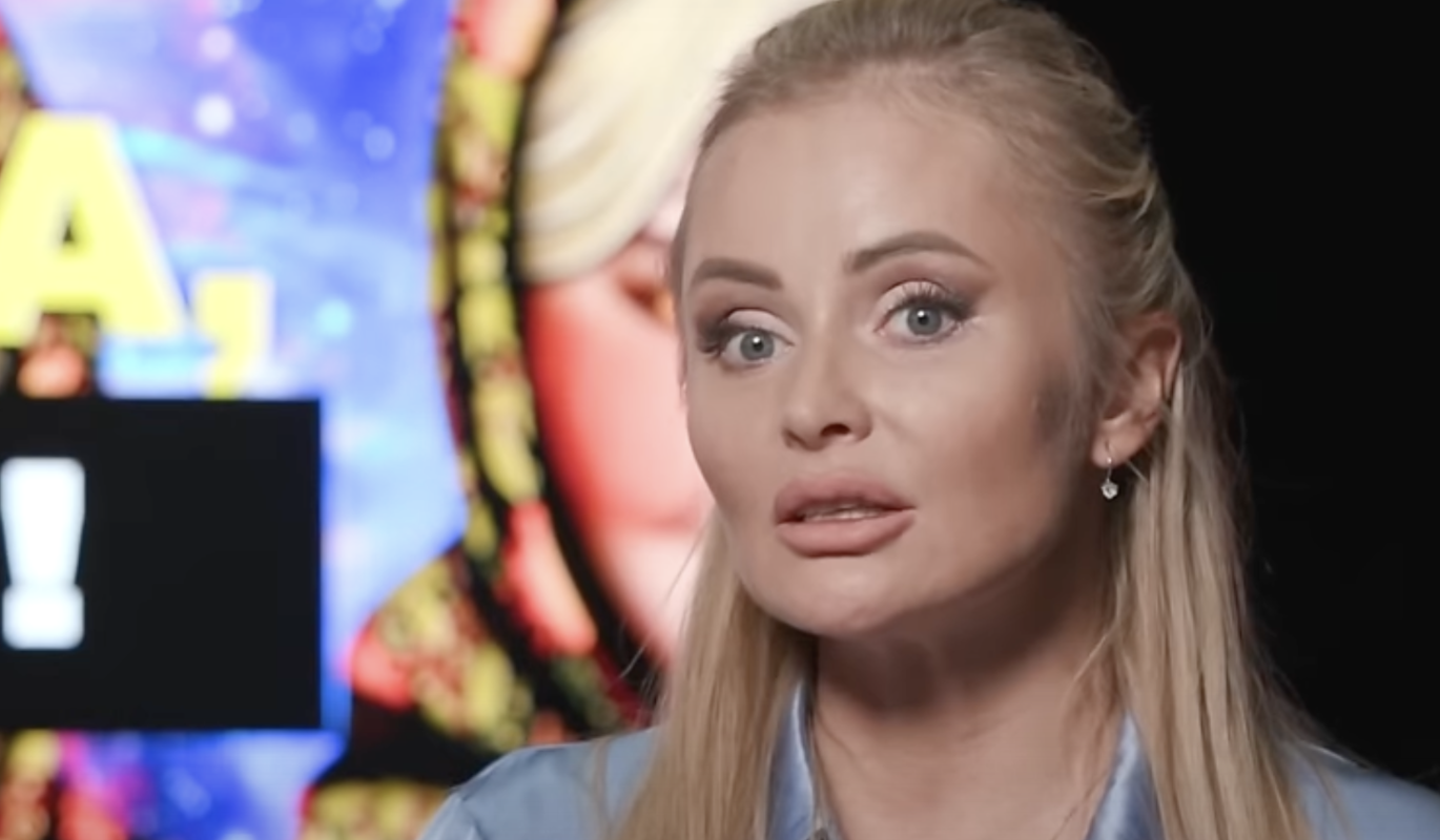 Дана Борисова пострадала в результате похудения