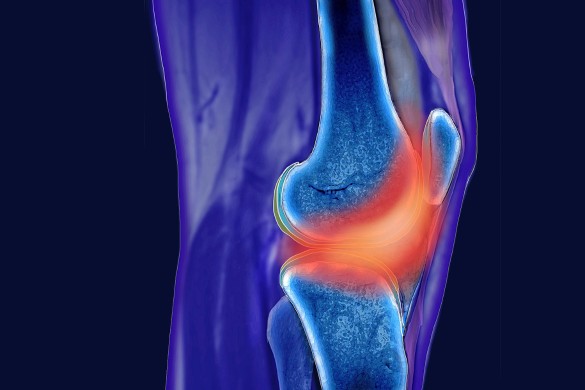 Почему болят колени во время болезни thumbnail