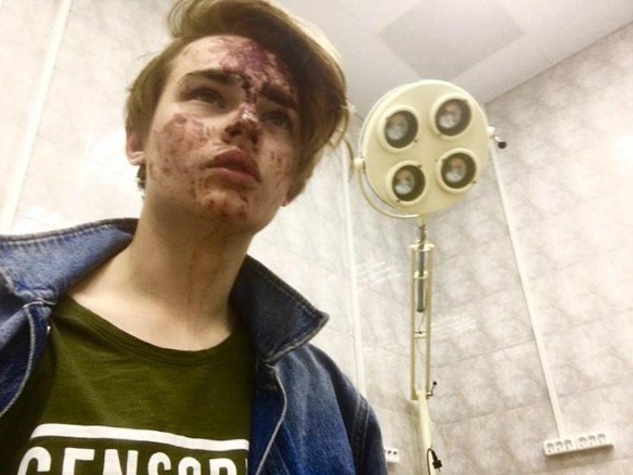 Жестоко избитая звезда "Дома-2" попала в больницу: шокирующие фото