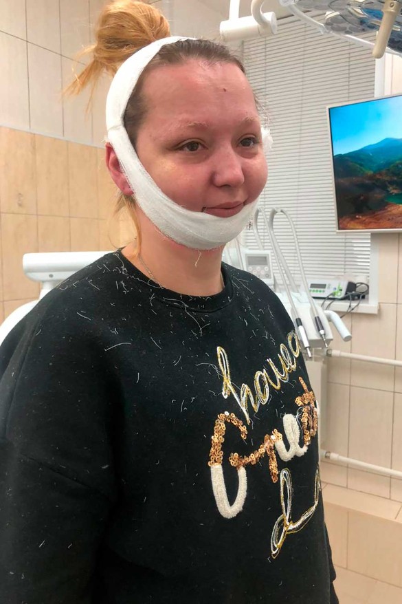 Елена Королева в больнице после драки. Фото: Дни.ру