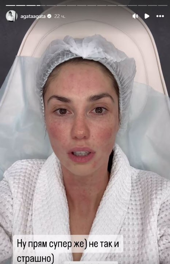 Фото: соцсети / @agataagata