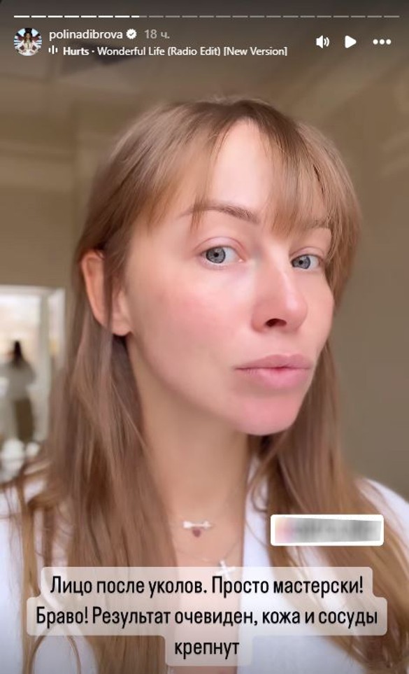 Фото: соцсети / @polinadibrova