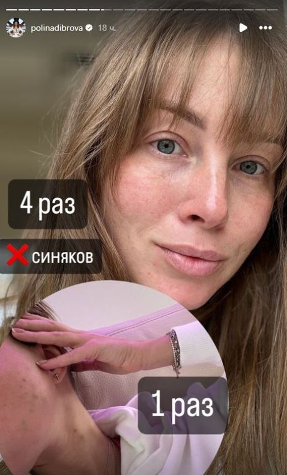 Фото: соцсети / @polinadibrova