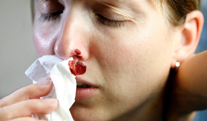 Инсульт и смерть: чем опасно кровотечение из носа?