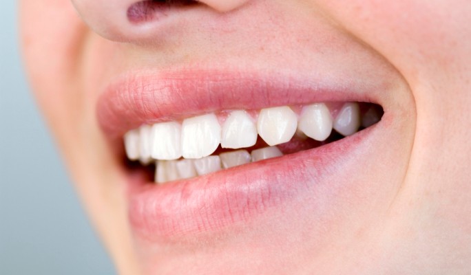 Что такое зубной камень и почему он возникает?