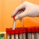 У Анастасии Киушкиной подтвердился коронавирус 