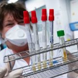 В ВОЗ сделали пугающее заявление о коронавирусе