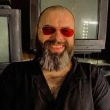 Кожа да кости: истощавший на карантине Фадеев напугал синяками