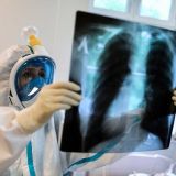 Число зараженных COVID-19 в России перевалило за 420 тысяч 