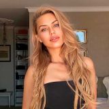 Викторию Боню перекосило после уколов в лицо