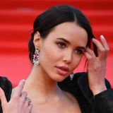 Решетову втянули в скандал из-за страшных ожогов