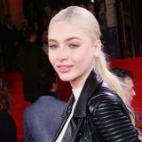 Шишкова перенесла пластическую операцию