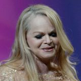 Изменившееся лицо Долиной вызвало шок 