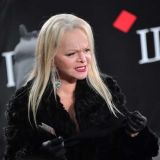 Надменная Долина публично отчитала неопытного Билана