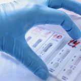 За сутки в России выявили больше 36 тысяч новых случаев ковида