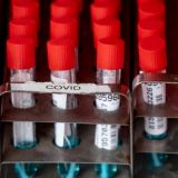 Россия закрывает границы из-за смертоносного штамма коронавируса из ЮАР