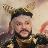 Опухшего Киркорова невозможно узнать