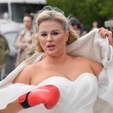 Семенович рассказала о реабилитации после липосакции