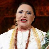 Стоматолога удивил результат реставрации зубов Надежды Бабкиной