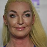 Волочкова предстала перед поклонниками в желтом купальнике