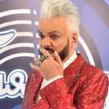 Фото бритоголового Киркорова удивило публику