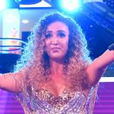 Врач посоветовал Ольге Бузовой с опухшим лицом обратиться к специалистам