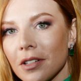 Подольская раскрыла причину появления синяков