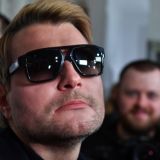 Причиной болезни Баскова может быть образ жизни – врач-флеболог