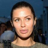 Боня показала фотографии своего лица после пластики