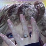 Американский зять помог избавиться Пугачевой от портящего лицо дефекта 