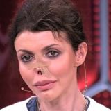 Пережившая деформацию носа бывшая жена Аршавина отметила 41-летие