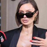 Отдавшая 19 миллионов за пластическую операцию Боня вновь обратилась к косметологу