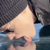 Лижущему лед SHAMANу врачи поставили неутешительный диагноз